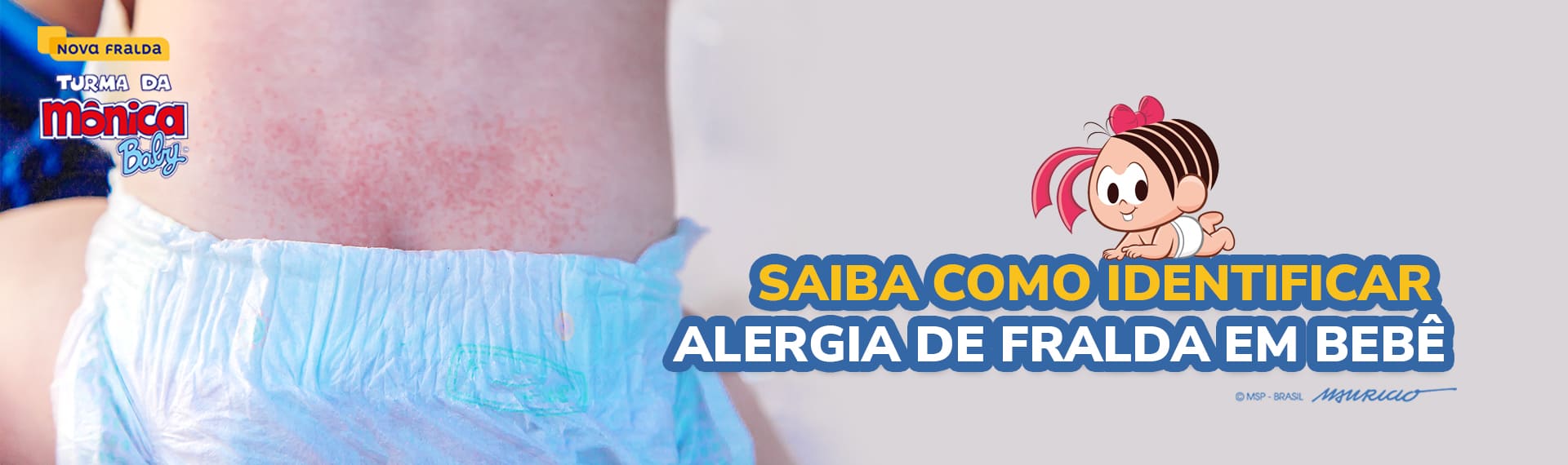 Alergia de fralda em bebê
