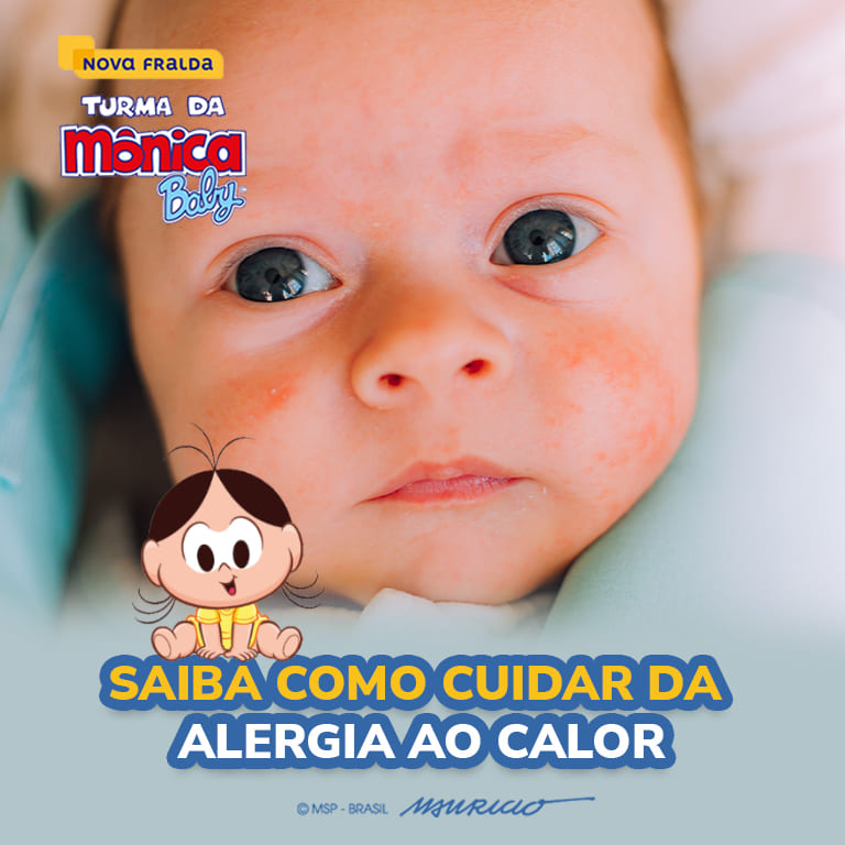 Como Aliviar a Alergia do Calor em Bebê | Turma da Mônica baby